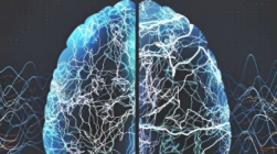颅脑癫痫手术后罕见的出血并发症